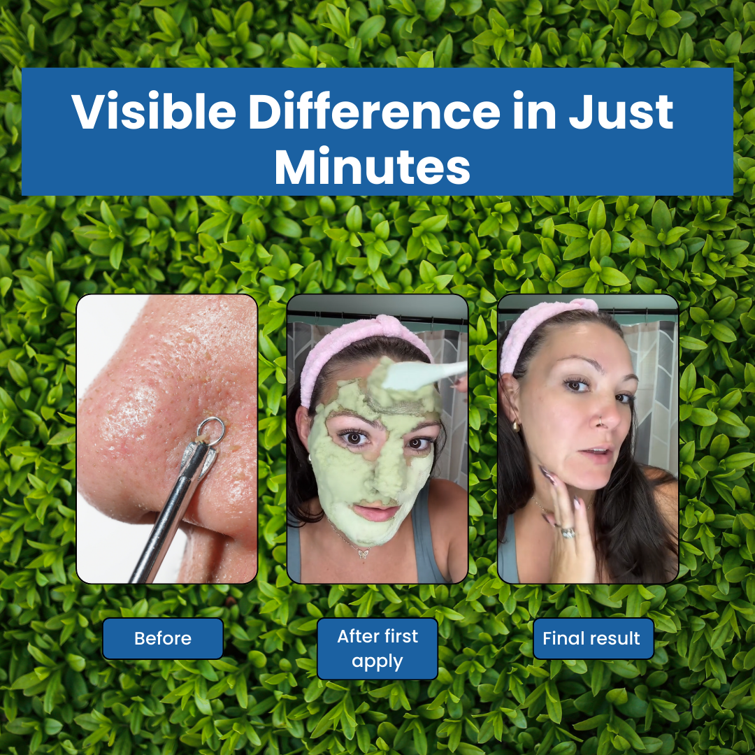BasilGlow™ Bubble Mask
